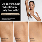 Braun Silk·expert Pro 5 IPL: Alternative to Laser Hair Removal with 2 Caps and Leather Pouch PL5157