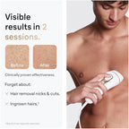Braun Smart IPL Silk·Expert Pro 5: At Home Alternative to Laser Hair Removal with Wide Cap and Leather Pouch IPL5145