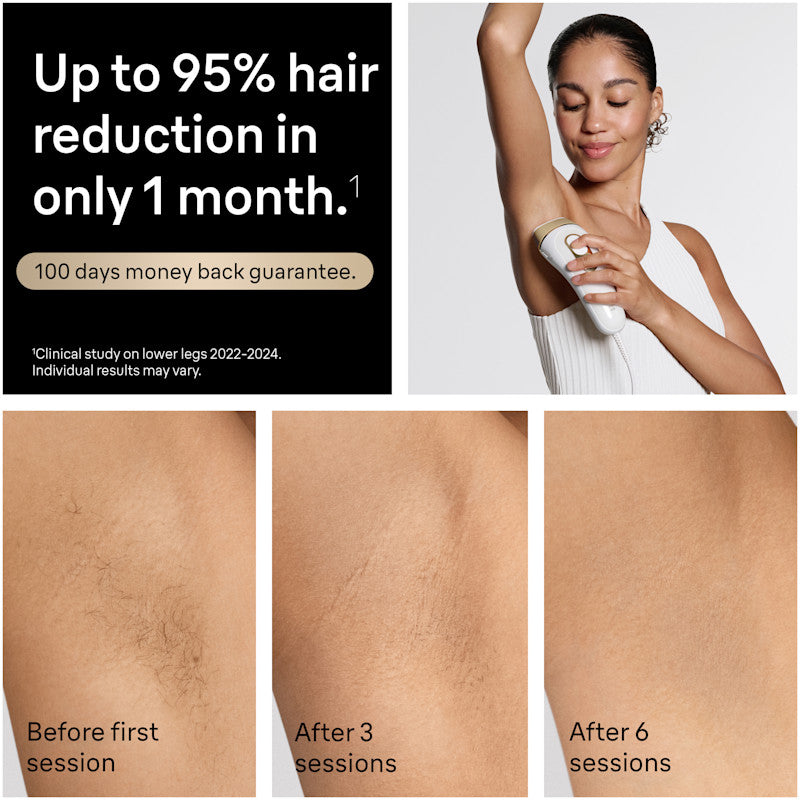 Braun Smart IPL Silk·Expert Pro 5: At Home Alternative to Laser Hair Removal with 2 Caps and Leather Pouch IPL5137