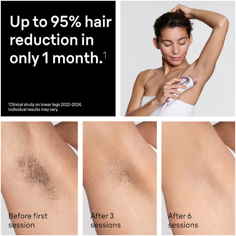 Braun Skin i·expert Smart IPL: At Home Alternative to Laser Hair Removal with 3 Caps and Leather Pouch PL7243